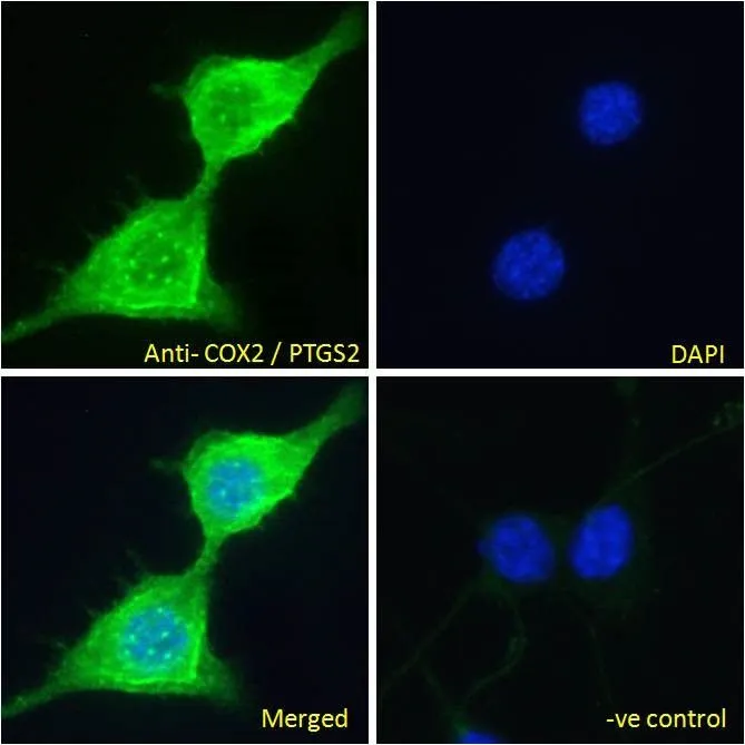 ICC/IF analysis of PFA fixed NIH-3T3 cells using GTX15839 COX2 antibody, C-term. Green : Primary antibody Blue : DAPI Negative control : Unimmunized goat IgG Permeabilization : 0.15% Triton Dilution : 10microg/ml