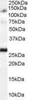 WB analysis of Daudi lysate using GTX15840 Importin 7 antibody,C-term. Dilution : 1ug/ml Loading : 35ug protein in RIPA buffer