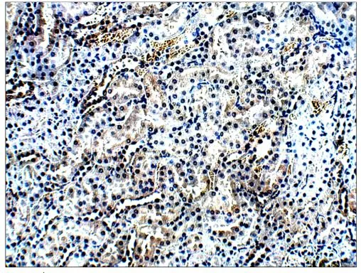 IHC-P analysis of rat kidney tissue using GTX15893 AMACR antibody.<br>Dilution : 1:100