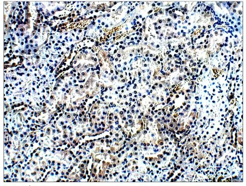 IHC-P analysis of rat kidney tissue using GTX15893 AMACR antibody. Dilution : 1:100 IHC-P analysis of rat kidney tissue using GTX15893 AMACR antibody. Dilution : 1:100