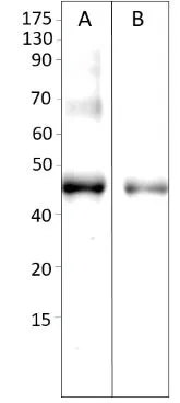 WB analysis of HEK293 cells using GTX15894 AMACR antibody. Dilution : 1:500 WB analysis of HEK293 cells using GTX15894 AMACR antibody. Dilution : 1:500