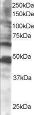 WB analysis of human brain lysate using GTX15917 CPEB1 antibody, C-term. Dilution : 0.5microg/ml Loading : 35microg protein in RIPA buffer WB analysis of human brain lysate using GTX15917 CPEB1 antibody, C-term. Dilution : 0.5microg/ml Loading : 35microg protein in RIPA buffer