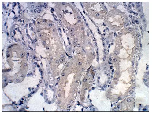 IHC-P analysis of baboon kidney tissue using GTX15951 CHERP antibody.<br>Dilution : 1:100