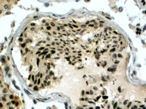 IHC-P analysis of human testis using GTX15957 RAD51AP1 antibody, C-term. Antigen retrieval : citrate buffer pH 6 Dilution : 4microg/ml IHC-P analysis of human testis using GTX15957 RAD51AP1 antibody, C-term. Antigen retrieval : citrate buffer pH 6 Dilution : 4microg/ml