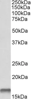 WB analysis of human lungs using GTX15970 Cystatin B antibody, C-term. Dilution : 0.1microg/ml Loading : 35microg protein in RIPA buffer WB analysis of human lungs using GTX15970 Cystatin B antibody, C-term. Dilution : 0.1microg/ml Loading : 35microg protein in RIPA buffer