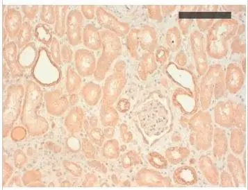 Immunohistochemical analysis of paraffin embedded human kidney with cytokeratin type II antibody [AE3]