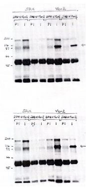 HEK293 cells were transfected with either emply expression vector (pSR ) or pSRa-Vav2 driving expression of human Vav2. Indicated antibodies (SHD or DPH) were used to immunoprecipitate Vav2 from 300ug protein lysates. Immunoprecipitated activity was identified by immunoblot of complexes using either DPH (upper gel) or SHD (lower gel) antisera at (1:10000). Immunoprecipitation of Endogenous/Exogenous Vav2 from HEK 283 (75 u g lysate per lane). Top gel - i.p. Ab: DPH or SHD preimmune serum (2.5 l/300 g lysate). DPH or SHD alpha Vav2 antiserum (2.5 l/300 g lysate). Western Blot Ab: DPH anti Vav2 1:10000. Bottom Gel - i.p. Ab DPH or SHD preimmune sera (2.5 l/300 g lysate). DPH or SHD anti Vav2 antisera (2.5 l/300 g lysate). Werstern blot Ab - SHD anti Vav2 antibody 1:10000. HEK293 cells were transfected with either emply expression vector (pSR ) or pSRa-Vav2 driving expression of human Vav2. Indicated antibodies (SHD or DPH) were used to immunoprecipitate Vav2 from 300ug protein lysates. Immunoprecipitated activity was identified by immunoblot of complexes using either DPH (upper gel) or SHD (lower gel) antisera at (1:10000). Immunoprecipitation of Endogenous/Exogenous Vav2 from HEK 283 (75 u g lysate per lane). Top gel - i.p. Ab: DPH or SHD preimmune serum (2.5 l/300 g lysate). DPH or SHD alpha Vav2 antiserum (2.5 l/300 g lysate). Western Blot Ab: DPH anti Vav2 1:10000. Bottom Gel - i.p. Ab DPH or SHD preimmune sera (2.5 l/300 g lysate). DPH or SHD anti Vav2 antisera (2.5 l/300 g lysate). Werstern blot Ab - SHD anti Vav2 antibody 1:10000.