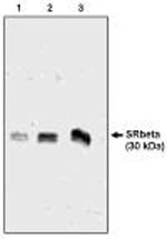 Western blot analysis using SR antibody on 3 (1),6 (2) and 12 (3) ng of canine microsomal protein