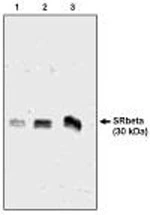 Western blot analysis using SR antibody on 3 (1), 6 (2) and 12 (3) ng of canine microsomal protein Western blot analysis using SR antibody on 3 (1), 6 (2) and 12 (3) ng of canine microsomal protein