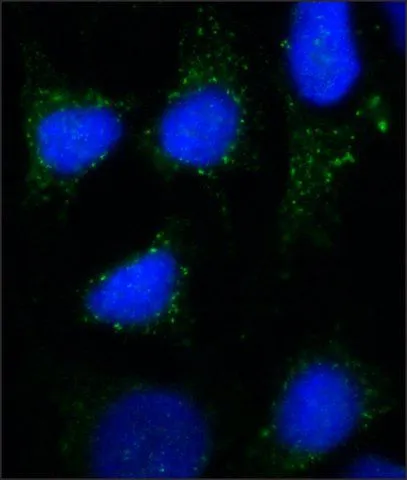 WB analysis of (1)HeLa (2) HepG2 (3) NRK (4)3T3 (5) MDCK cells using GTX16196 RAB7A antibody [Rab7-117] at 1 ug/mL.