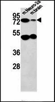 WB analysis of Neuro-2a cell and mouse brain tissue lysates using GTX16209 AVL9 antibody.