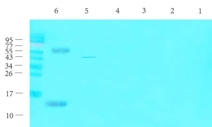 WB analysis of rat thyroid (Lane 1),rat liver (Lane 2),rat pancreas (Lane 3),mouse brain (Lane 4),mouse spinal cord (Lane 5),human thyroid cancer (Lane 6) tissue lysates using GTX16211 CGRP antibody. Dilution : 1ug/ml