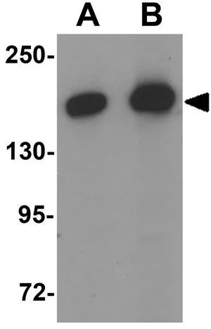 WB analysis of A-20 cell lysate using GTX16240 ARHGAP39 antibody. Working concentration : (A) 1 and (B) 2 microg/ml WB analysis of A-20 cell lysate using GTX16240 ARHGAP39 antibody. Working concentration : (A) 1 and (B) 2 microg/ml