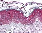 IHC-P analysis of human skin tissue using GTX16242 ARHGEF11 antibody. IHC-P analysis of human skin tissue using GTX16242 ARHGEF11 antibody.