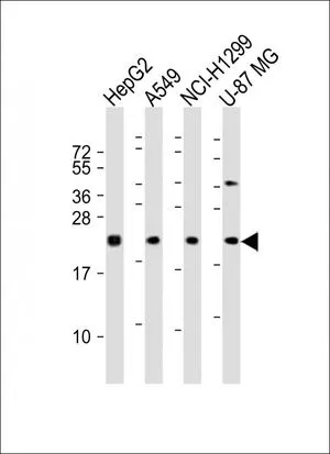 WB analysis of various samples using GTX16256 Epiregulin antibody. Lane 1: HepG2 whole cell lysates Lane 2: A549 whole cell lysates Lane 3: NCI-H1299 whole cell lysates Lane 4: U-87 MG whole cell lysates Loading : 20 microg per lane Dilution : 1:2000