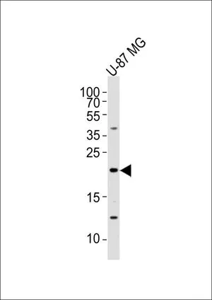 WB analysis of U-87 MG whole cell lysate using GTX16256 Epiregulin antibody. Loading : 20 microg per lane Dilution : 1:2000