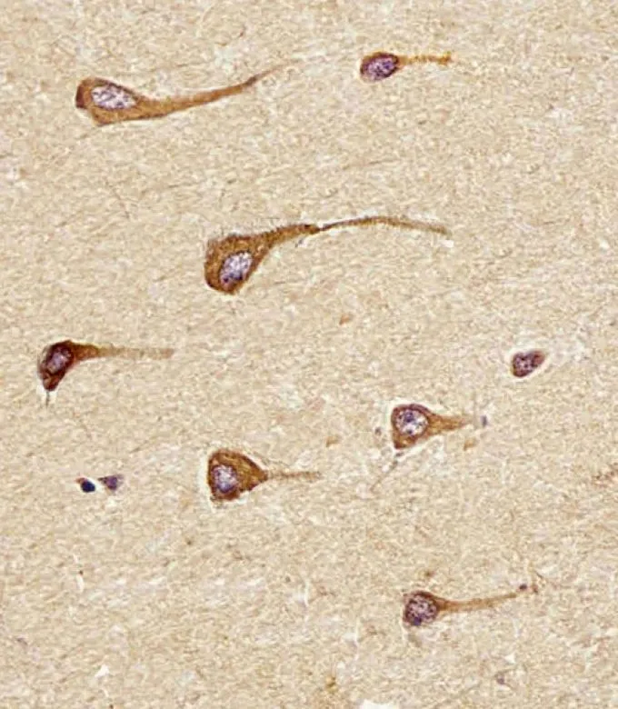IHC-P analysis of human brain tissue using GTX16256 Epiregulin antibody. Antigen retrieval : heat-induced antigen retrieval with a citrate buffer (pH6) Dilution : 1:25
