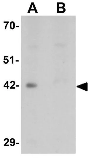 WB analysis of mouse kidney tissue lysate in (A) the absence and (B) the presence of blocking peptide using GTX16275 DPAGT1 antibody. Working concentration : 1 microg/ml WB analysis of mouse kidney tissue lysate in (A) the absence and (B) the presence of blocking peptide using GTX16275 DPAGT1 antibody. Working concentration : 1 microg/ml