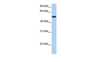 WB analysis of HeLa cells using GTX16278 GALNT13 antibody at 0.2-1microg/ml. WB analysis of HeLa cells using GTX16278 GALNT13 antibody at 0.2-1microg/ml.