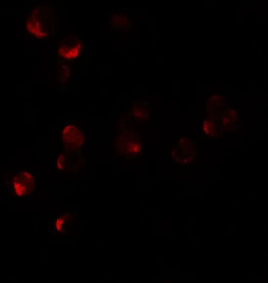 ICC/IF analysis of 293 cells using GTX16279 HIGD1A antibody. Working concentration : 10 microg/ml ICC/IF analysis of 293 cells using GTX16279 HIGD1A antibody. Working concentration : 10 microg/ml