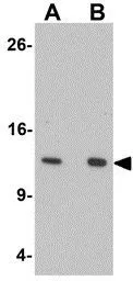 WB analysis of 293 cell lysate using GTX16279 HIGD1A antibody. Working concentration : (A) 0.5 and (B) 1 microg/ml