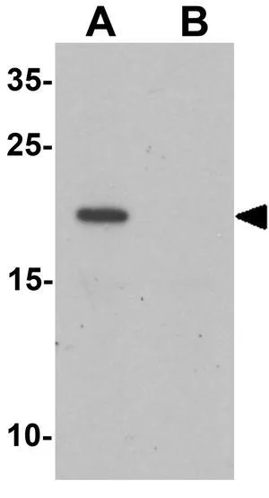 WB analysis of A-20 cell lysate in (A) the absence and (B) the presence of blocking peptide using GTX16303 LEMD1 antibody. Working concentration : 1 ug/ml