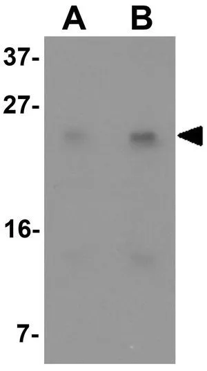 WB analysis of HeLa cell lysate using GTX16304 LY6K antibody. Working concentration : (A) 1 and (B) 2 ug/ml