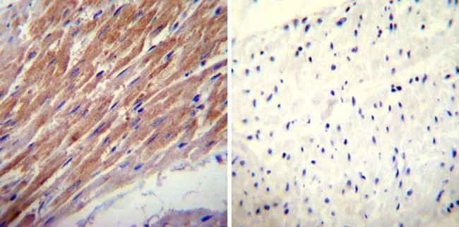 IHC-P analysis of human heart tissue using GTX16318 Glucocorticoid Receptor alpha antibody. Left : Primary antibody Right : Negative control without primary antibody Antigen retrieval : heat induced antigen retrieval was performed using 10mM sodium citrate (pH6.0) buffer, microwaved for 8-15 minutes Dilution : 1:100