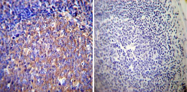 IHC-P analysis of human tonsil tissue using GTX16318 Glucocorticoid Receptor alpha antibody. Left : Primary antibody Right : Negative control without primary antibody Antigen retrieval : heat induced antigen retrieval was performed using 10mM sodium citrate (pH6.0) buffer, microwaved for 8-15 minutes Dilution : 1:50