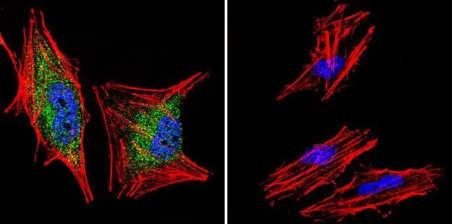 ICC/IF analysis of A2058 Cells using GTX16318 Glucocorticoid Receptor alpha antibody. Cells were probed without (right) or with(left) an antibody. Green : Primary antibody Blue : Nuclei Red : Actin Fixation : formaldehyde Dilution : 1:200 overnight at 4oC