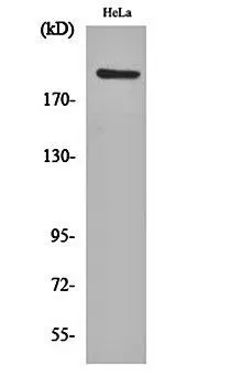 WB analysis of HeLa cell lysate using GTX16325 PHF3 antibody. WB analysis of HeLa cell lysate using GTX16325 PHF3 antibody.