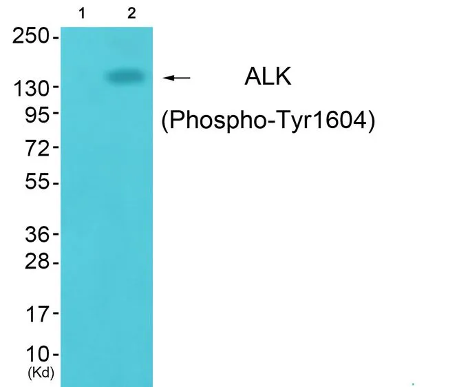 IHC-P analysis of human brain tissue using GTX16377 ALK (phospho Tyr1604) antibody. Left : Primary antibody Right : Primary antibody pre-incubated with the antigen specific peptide