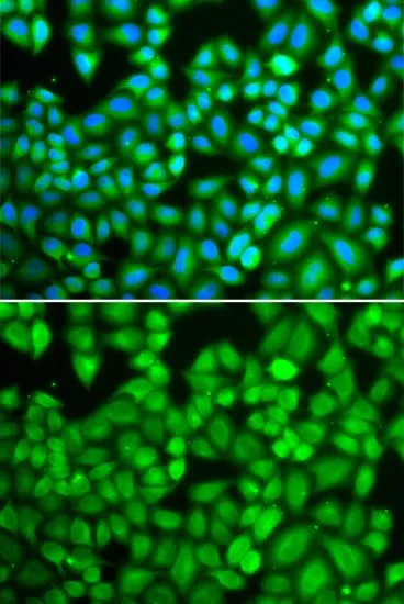 ICC/IF analysis of U2OS cells using GTX16382 WASP antibody. Blue : DAPI