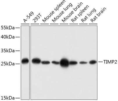 WB analysis of various sample lysates using GTX16392 TIMP2 antibody. Dilution : 1:1000 Loading : 25microg per lane WB analysis of various sample lysates using GTX16392 TIMP2 antibody. Dilution : 1:1000 Loading : 25microg per lane