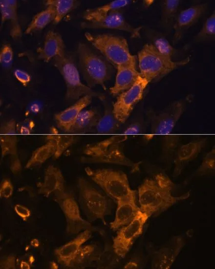 ICC/IF analysis of U2OS cells using GTX16392 TIMP2 antibody. Blue : DAPI Dilution : 1:100