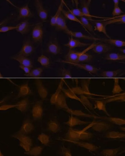 ICC/IF analysis of C6 cells using GTX16392 TIMP2 antibody. Blue : DAPI Dilution : 1:100