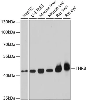 WB analysis of various sample lysates using GTX16393 Thyroid Hormone Receptor beta antibody. The signal was developed with ECL plus-Enhanced. Dilution : 1:1000 Loading : 25microg per lane WB analysis of various sample lysates using GTX16393 Thyroid Hormone Receptor beta antibody. The signal was developed with ECL plus-Enhanced. Dilution : 1:1000 Loading : 25microg per lane