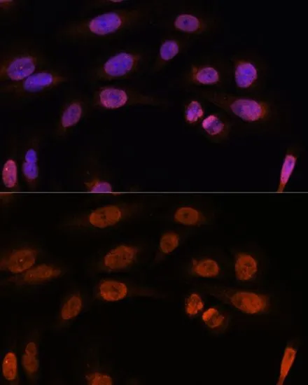 ICC/IF analysis of U2OS cells using GTX16393 Thyroid Hormone Receptor beta antibody. Blue : DAPI Dilution : 1:100
