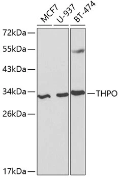WB analysis of various sample lysates using GTX16398 Thrombopoietin antibody. The signal was developed with ECL plus-Enhanced. Dilution : 1:1000 Loading : 25microg per lane WB analysis of various sample lysates using GTX16398 Thrombopoietin antibody. The signal was developed with ECL plus-Enhanced. Dilution : 1:1000 Loading : 25microg per lane