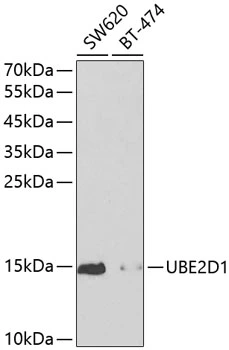 WB analysis of various sample lysates using GTX16400 UBE2D1 antibody. The signal was developed with ECL plus-Enhanced. Dilution : 1:1000 Loading : 25microg per lane WB analysis of various sample lysates using GTX16400 UBE2D1 antibody. The signal was developed with ECL plus-Enhanced. Dilution : 1:1000 Loading : 25microg per lane