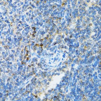 IHC-P analysis of mouse spleen tissue using GTX16400 UBE2D1 antibody. Dilution : 1:100