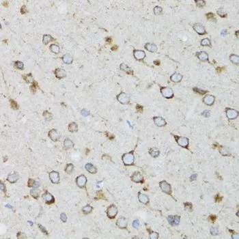 IHC-P analysis of rat brain tissue using GTX16400 UBE2D1 antibody. Dilution : 1:100