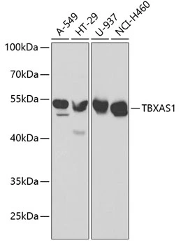 WB analysis of various sample lysates using GTX16403 TXA synthase antibody. Dilution : 1:1000 Loading : 25microg per lane WB analysis of various sample lysates using GTX16403 TXA synthase antibody. Dilution : 1:1000 Loading : 25microg per lane