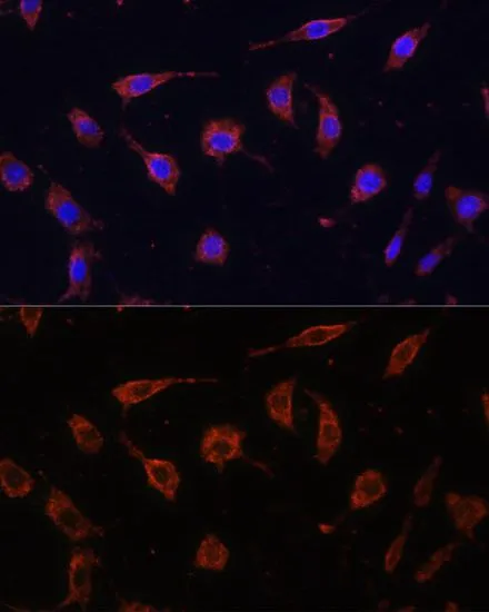 ICC/IF analysis of L929 cells using GTX16406 Tollip antibody. Blue : DAPI Dilution : 1:100