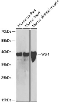 WB analysis of various samples using GTX16429 WIF1 antibody.The signal was developed with ECL plus-Enhanced. Dilution : 1:1000 Loading : 25ug per lane