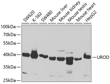 WB analysis of various sample lysates using GTX16432 UROD antibody. Dilution : 1:1000 Loading : 25microg per lane WB analysis of various sample lysates using GTX16432 UROD antibody. Dilution : 1:1000 Loading : 25microg per lane