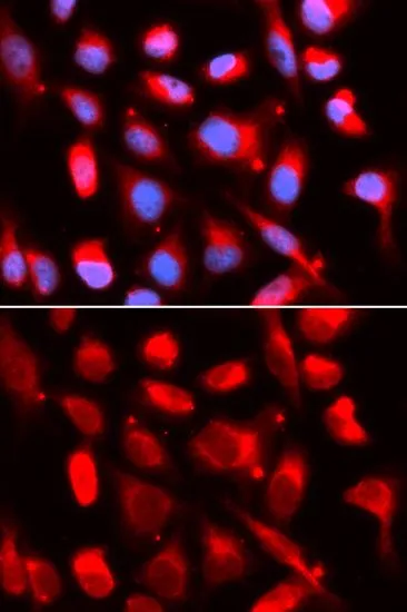 ICC/IF analysis of U2OS cells using GTX16432 UROD antibody. Blue : DAPI