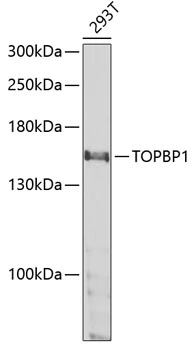 WB analysis of 293T cell lysate using GTX16438 TOPBP1 antibody. The signal was developed with ECL plus-Enhanced. Dilution : 1:1000 Loading : 25microg per lane WB analysis of 293T cell lysate using GTX16438 TOPBP1 antibody. The signal was developed with ECL plus-Enhanced. Dilution : 1:1000 Loading : 25microg per lane
