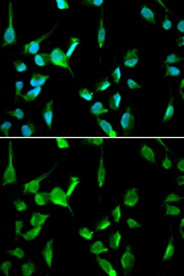 ICC/IF analysis of A549 cells using GTX16438 TOPBP1 antibody. Blue : DAPI