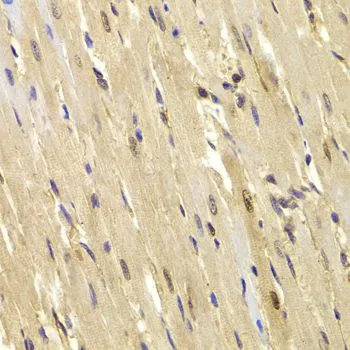 IHC-P analysis of mouse heart tissue using GTX16438 TOPBP1 antibody. Dilution : 1:100